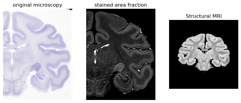 _images/TIRL_BigMac_demo-mapping_microscopy_to_mri_3_1.png