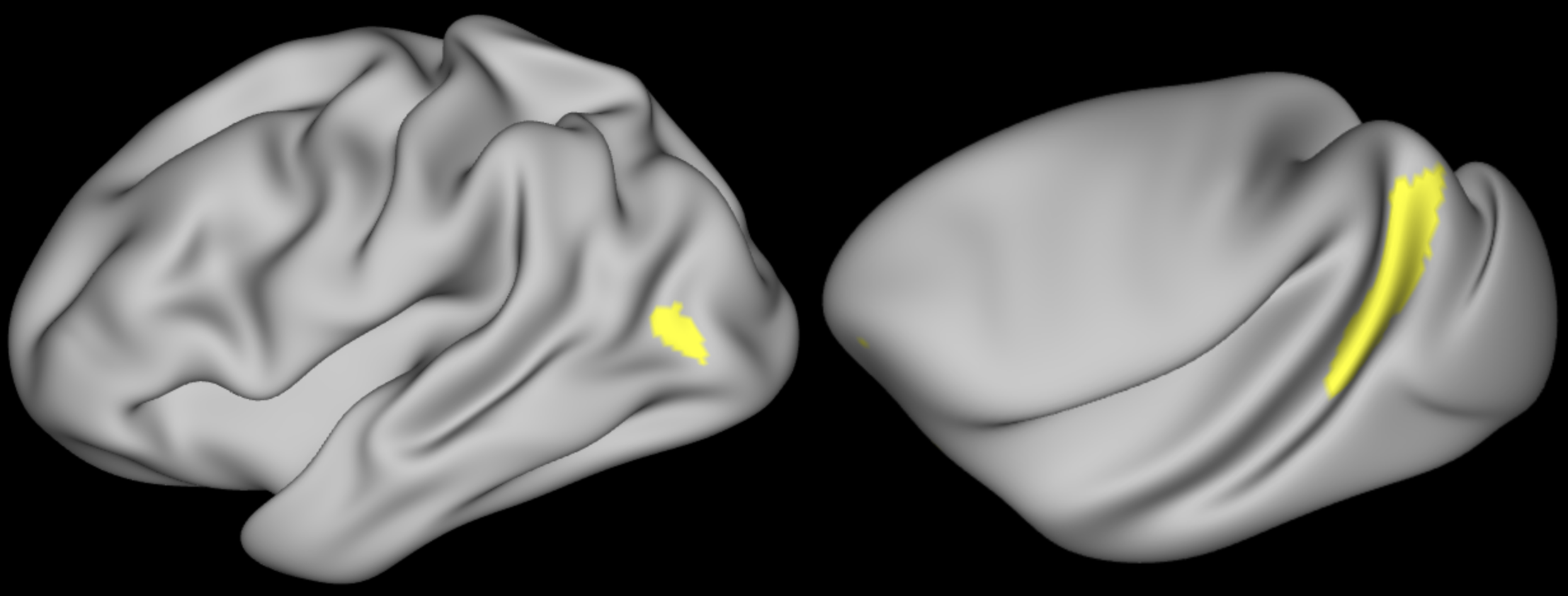 Human (left) and macaque (right) MT+ ROIs