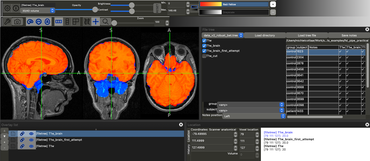 fsleyes robust brain extraction